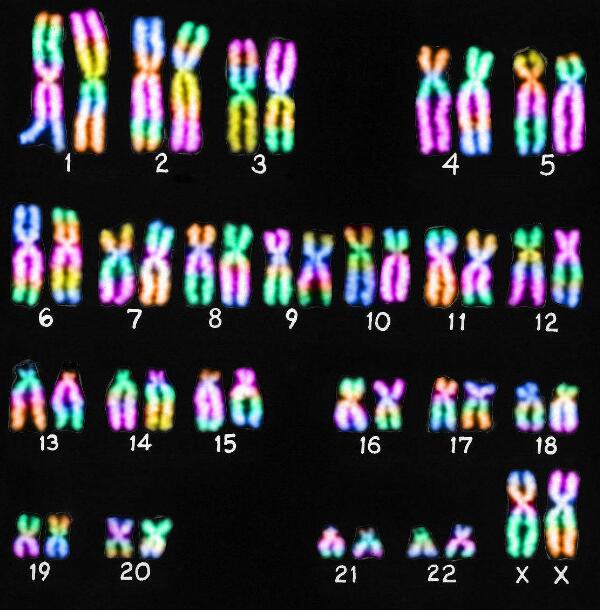 23对染色体